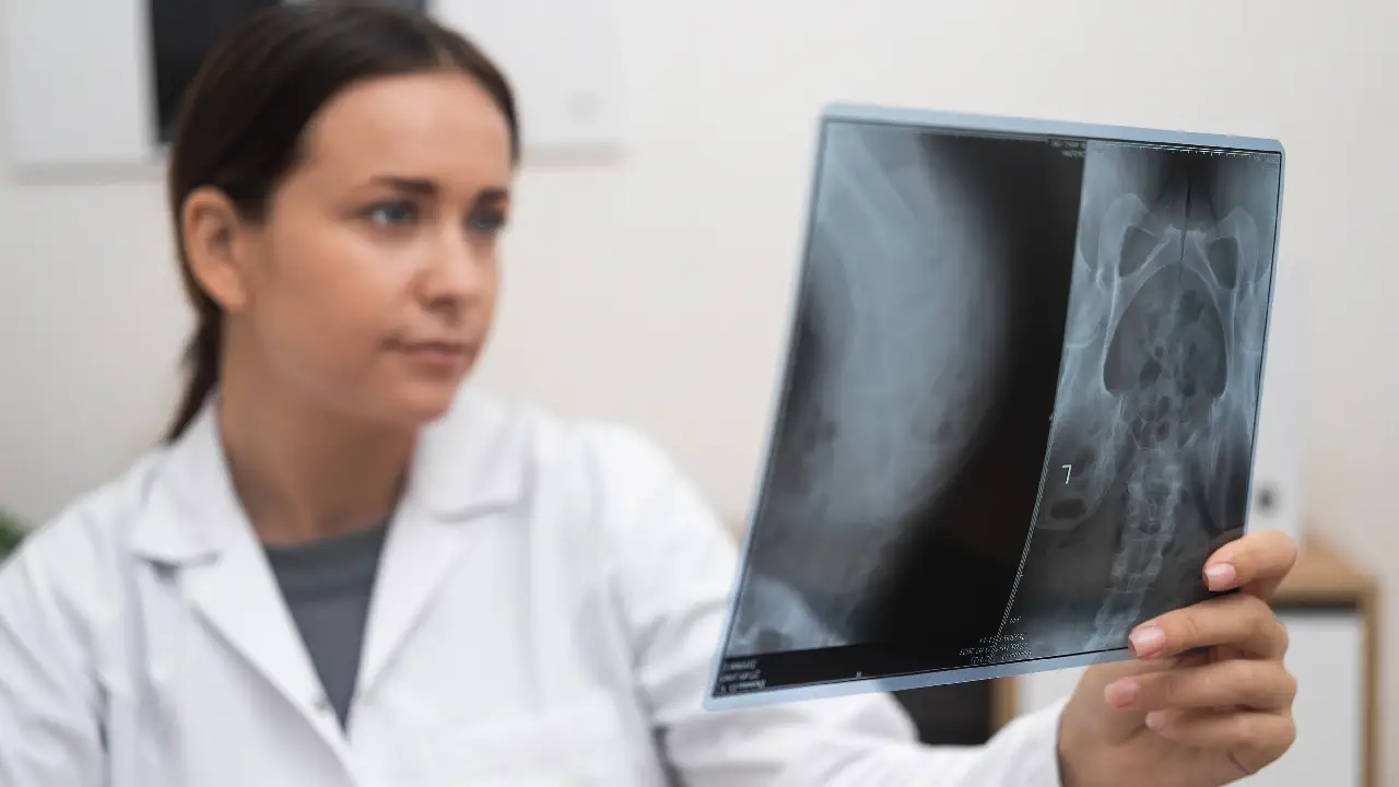 A doctor carefully reviews an x-ray, emphasizing the significance of maintaining bone strength through ESS60 in Olive Oil